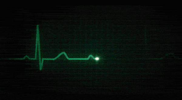 Machine Health
